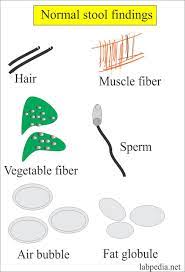 Stool Examination Part 1 Stool Analysis Stool For Ova And Parasite Complete Stool Studies Labpedia Net Stool Smears Analysis