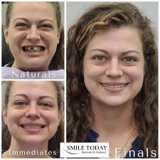 Eric Mead (@smiletodaydentures) · Yukon, OK