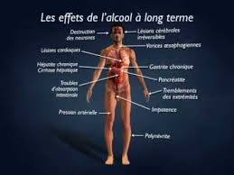 En général, l'alcool a un effet anesthésiant ; L Alcool Savoir Fr