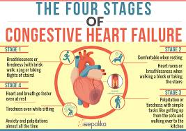 Congestive Heart Failure Chf Symptoms Stages Life