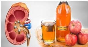 Cuka apel adalah fermentasi sari apel dengan menggunakan ragi dan bakteri lainnya. Bikin Sendiri Cuka Apel Untuk Kesehatan Dan Kecantikan Ini Cara Membuatnya Moms