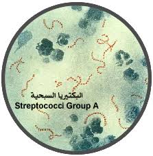 For both unvaccinated and vaccinated people, pcr is the most reliable method for confirming infection. ØªØ­Ù„ÙŠÙ„ Aso Anti Streptolysin O Titre