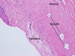 Image result for Sclera