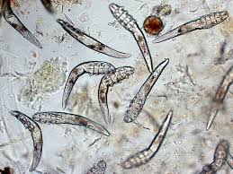 Image result for Demodex folliculorum