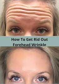 How To Get Rid Out Forehead Wrinkle Prodotti Per Il Viso Rughe Zampe Di Gallina