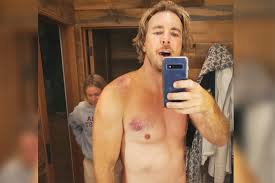 And the groundlings school, los angeles. Dax Shepard To Have Surgery After Motorcycle Accident Fr24 News English