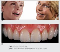 Visagism: The Art of Dental Composition