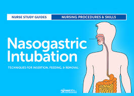 nasogastric intubation insertion procedures technique