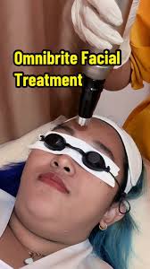 Got my Omnibrite facial treatment at Nue Aesthetics recently. This is  perfect for people with melasma concerns since it lightens dark spots and  evens out your skin tone. #NueAesthetics