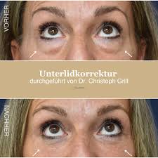 Dr. Christoph Grill (@dr_christoph_grill) · Instagram photos and videos