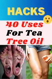 Tea Tree Oil Is More Useful Than You Think Here Are 40 Reasons You Need It At Home Life Hacks Home Diy Life Hacks Life Hacks