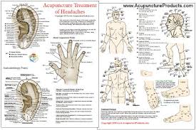 acupuncture treatment of headaches chart