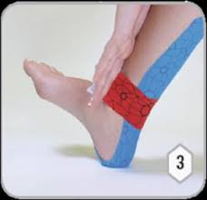 Image result for Taping for Soleus and Achilles