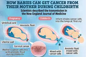 Lung cancer can spread to the bones, explains mckee. Two Babies Develop Cancer After Inhaling Disease During Childbirth Study Reveals