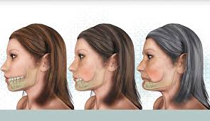 In this video i show you mewing for hollow cheeks | how to get a defined facefalim gum: Sunken Face How Multiple Missing Teeth Affect Your Face
