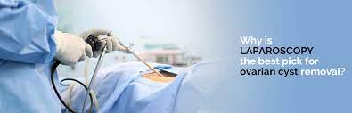 Why Is Laparoscopy The Best Pick For Ovarian Cyst Removal Medipulse Best Private Hospital In Jodhpur