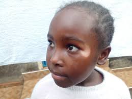 Is Wendy's mom using lightening cream or does she have vitiligo?