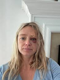 It's always possible my friend. You slipped and that's unfortunate. But  it's not the end unless you want it to be. It's all there in your mind.  Your need to drink, your