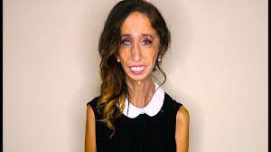Comment must not exceed 1000 characters. Etats Unis La Femme La Plus Moche Du Monde Se Bat Contre Le Harcelement Sur Le Net Ladepeche Fr