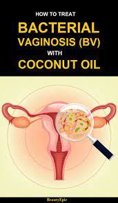 Pin On Home Remedies Substitutions