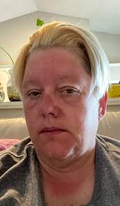 Forget the gym...ok, this may be alittle desperate, i can hardly walk. Ohio  field hunting