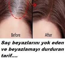 Bu Tarifle Sac Beyazlamasi Derdine Son Beyazlayan Saclari Eski Haline Donduren Sac Beyazlamasini Dur Hair Care Oil Hair Care Remedies Natural Hair Conditioner