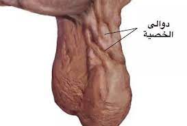 تتلاشى بسكويت كلاسيك عروق الخصية اليمنى guillotinpoilvet com