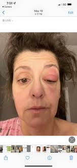 How to handle playing poker with health issues?