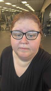 Weight loss and AFib reduction: exercise or surgery?