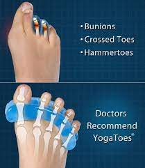 Yoga is a great treatment for bunions. The Consumer Adviser Attain Proper Foot Health With Yoga Toes Foot Health Bunion Remedies Health