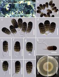 Maybe you would like to learn more about one of these? Fungal Diversity Notes 1036 1150 Taxonomic And Phylogenetic Contributions On Genera And Species Of Fungal Taxa Springerlink