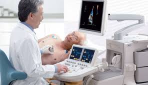Image result for ECHOCARDIOGRAPHY