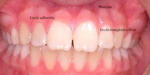 Anatomia Mucosa Y Boca Clinica Dental Mozas Vitoria Gazteiz
