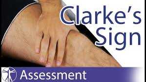 Image result for Patella Mobility Test