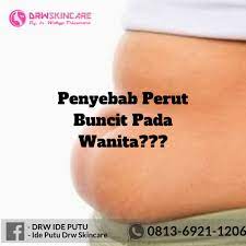 Perut buncit bukan hanya dialami oleh mereka yang mempunyai masalah kegemukan atau obesitas. Pin On Penyebab Perut Buncit Pada Wanita