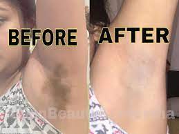 Let us go through some home remedies to have these cured soon How To Lighten Dark Underarm How To Get Rid Of Dark Underarm 2 Method Youtube