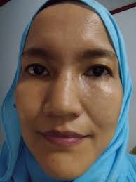 Check spelling or type a new query. Pengalaman Vitacid 0 025 Dan Pelembab Zat Aktif Icapicipaurora S Blog