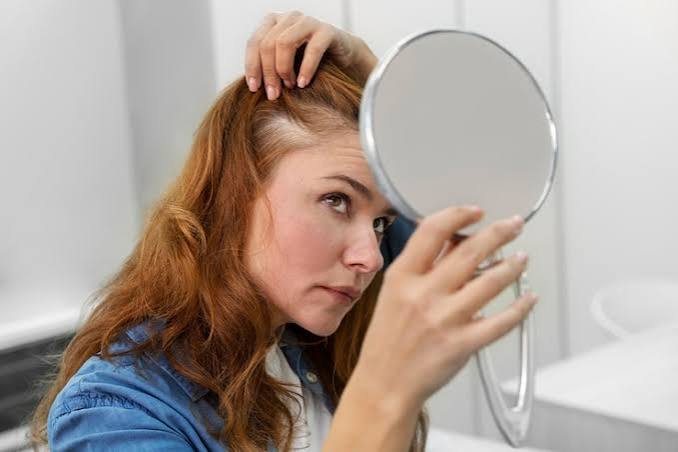Hair loss Images - Free Download on Magnific (formerly Freepik)