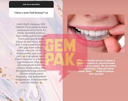 Perawatan gigi dan mulut terbilang cukup mahal, namun, tidak perlu khawatir, beberapa perawatan gigi ditanggung bpjs kesehatan, perawatan gigi apa saja? Gigi Mudah Bergerak Mira Filzah Habiskan Rm12 500 Untuk Kos Rawatan