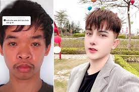 Vietnamese edition | jan 1, 2010. After Being Made Fun Of By An Interviewer Vietnamese Man Decides To Spend Rm70k To Change His Face Kaw Rojak Daily
