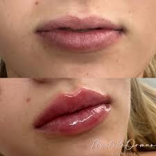 Michelle Orman Aesthetics