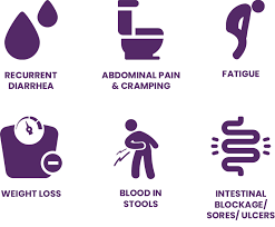 Abdominal pain or rectal pain. Ulcerative Colitis Ibd I Battle Disease