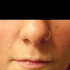 RealSelf: Daniel Belkin, MD