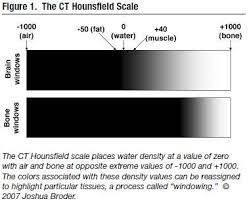 An Evidence Based Approach To Imaging Of Acute Neurological Conditions Magnetic Resonance Imaging Radiography White Matter