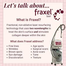 Solta Medical Midwest ➰ Austin Eicher