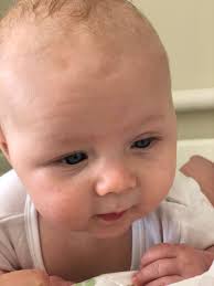 Well i just got a 2 week old hamster and i bought a bag of hamster food or you can feed it carrot and apple. Baby Has Bags Under Eyes Pics Included August 2019 Babies Forums What To Expect