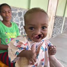 Samaritan's Purse Careers