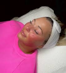 DAYTON, OH ESTHETICIAN (@byhanfort) • Instagram photos and videos