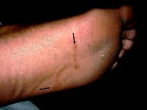 You may already have heard that worms often infect puppies and kittens as well as older pets. Hookworms Mar Vista Animal Medical Center