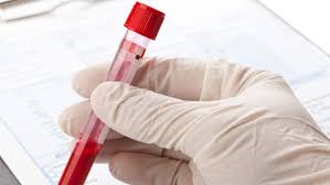 Wer eine menge an zeit bezüglich der untersuchungen auslassen will, möge sich an die genannte empfehlung in unserem cholesterin ab wann. Hohe Cholesterinwerte Richtig Behandeln Ndr De Ratgeber Gesundheit